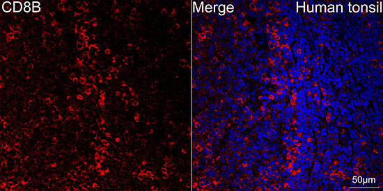 CD8B Beta Rabbit monoclonal antibody