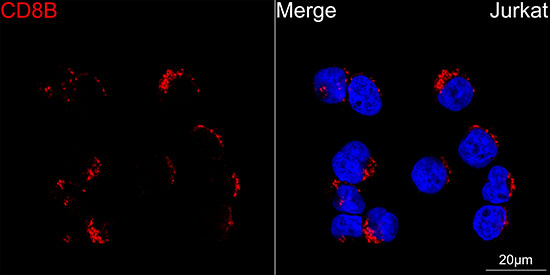 CD8B Beta Rabbit monoclonal antibody