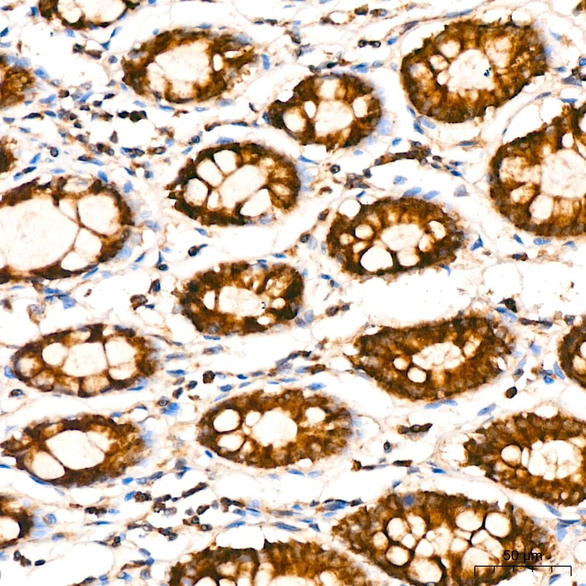Aldehyde dehydrogenase 5-A1/SSADH/ALDH5A1 Rabbit monoclonal antibody