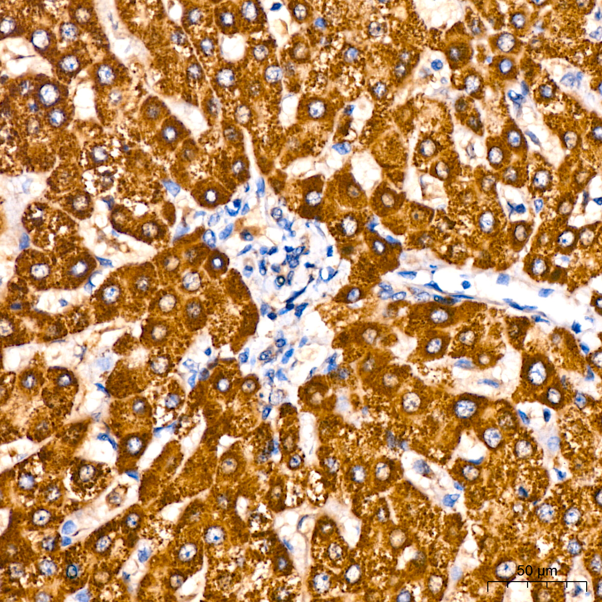 Aldehyde dehydrogenase 5-A1/SSADH/ALDH5A1 Rabbit monoclonal antibody
