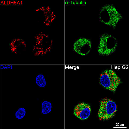 Aldehyde dehydrogenase 5-A1/SSADH/ALDH5A1 Rabbit monoclonal antibody