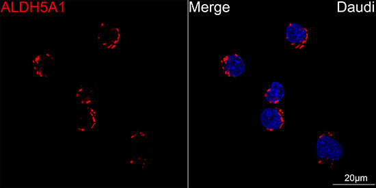 Aldehyde dehydrogenase 5-A1/SSADH/ALDH5A1 Rabbit monoclonal antibody