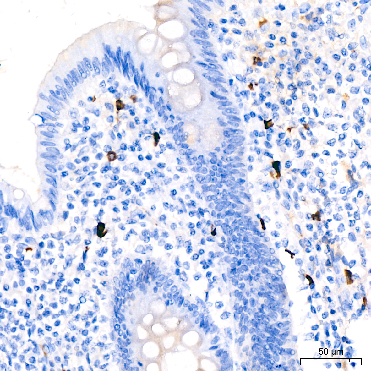 Human IgM Rabbit monoclonal antibody
