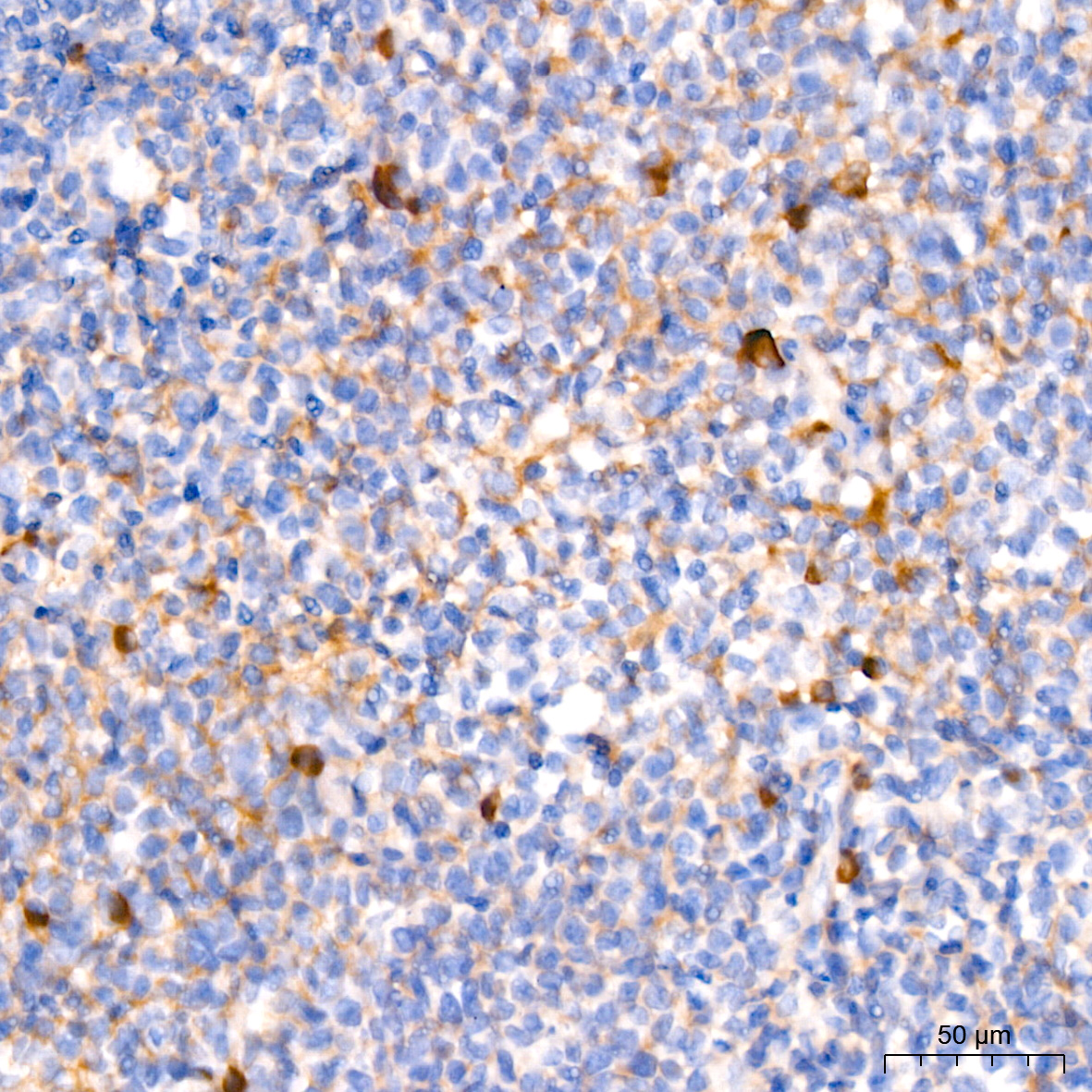 Human IgM Rabbit monoclonal antibody