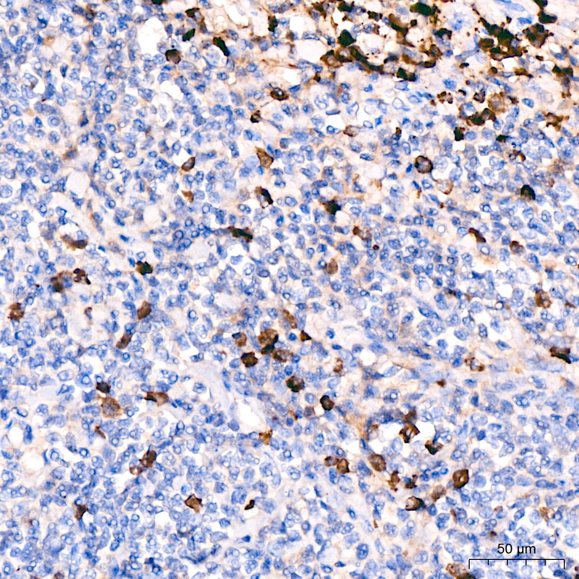 Human IgM Rabbit monoclonal antibody