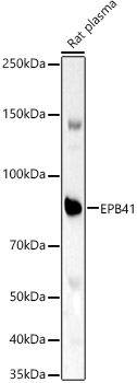 EPB41 Rabbit polyclonal antibody