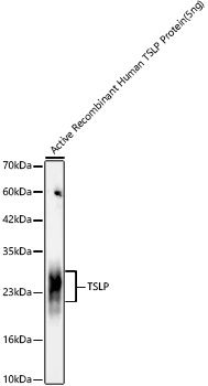 TSLP Rabbit monoclonal antibody