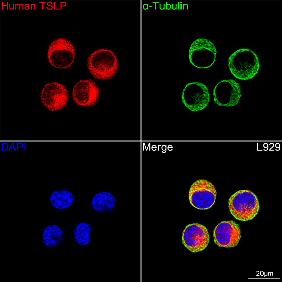 TSLP Rabbit monoclonal antibody