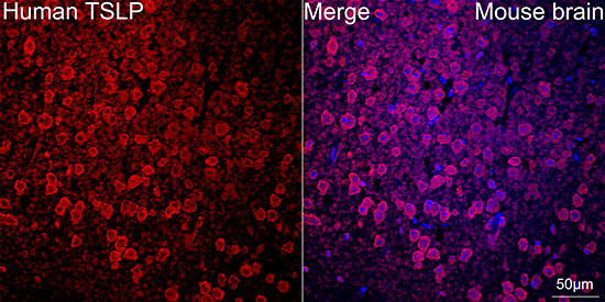 TSLP Rabbit monoclonal antibody