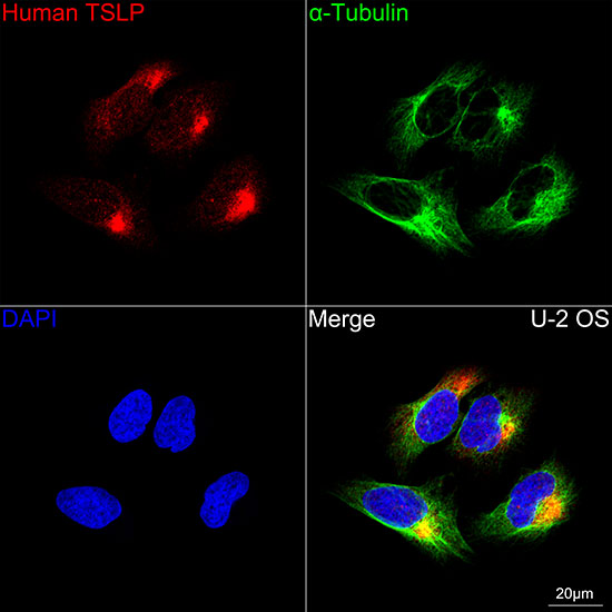TSLP Rabbit monoclonal antibody