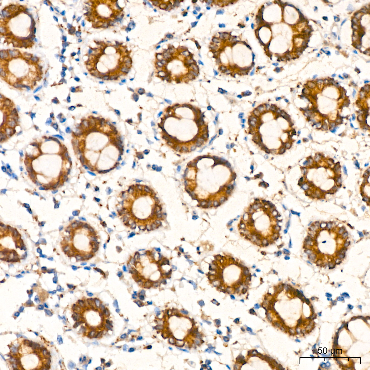AGMAT Rabbit monoclonal antibody