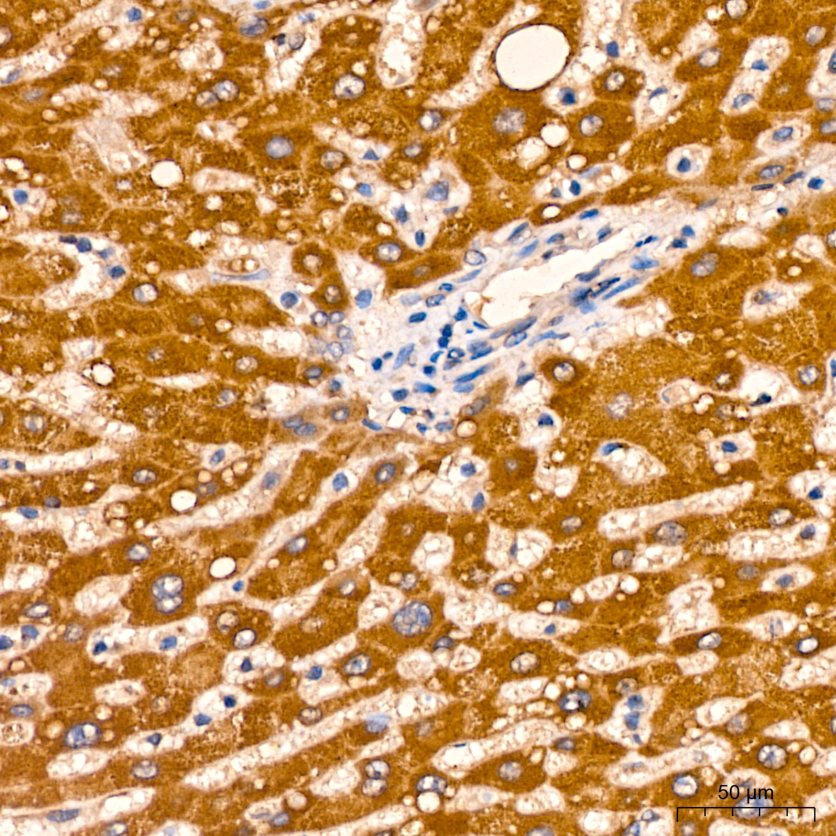 AGMAT Rabbit monoclonal antibody