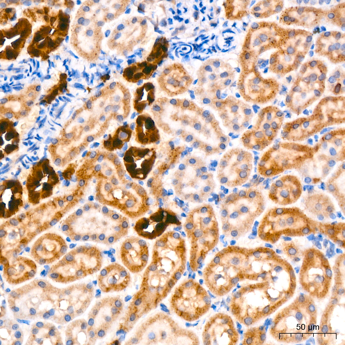 AGMAT Rabbit monoclonal antibody