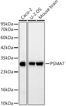 [KD Validated] PSMA7 Rabbit monoclonal antibody