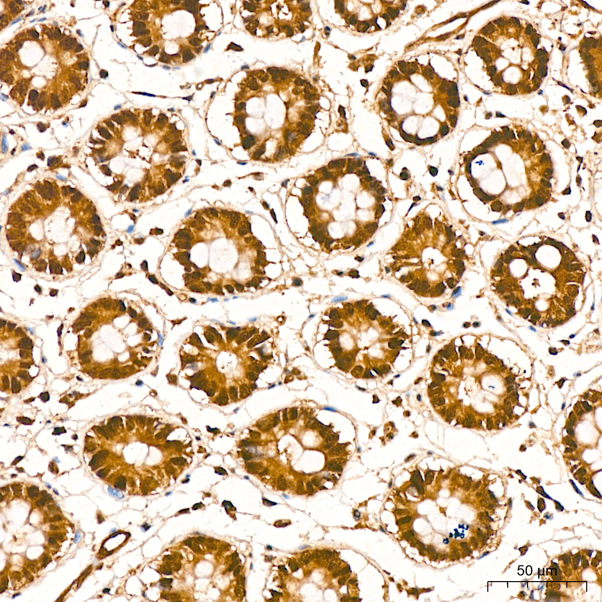 [KD Validated] PSMA7 Rabbit monoclonal antibody