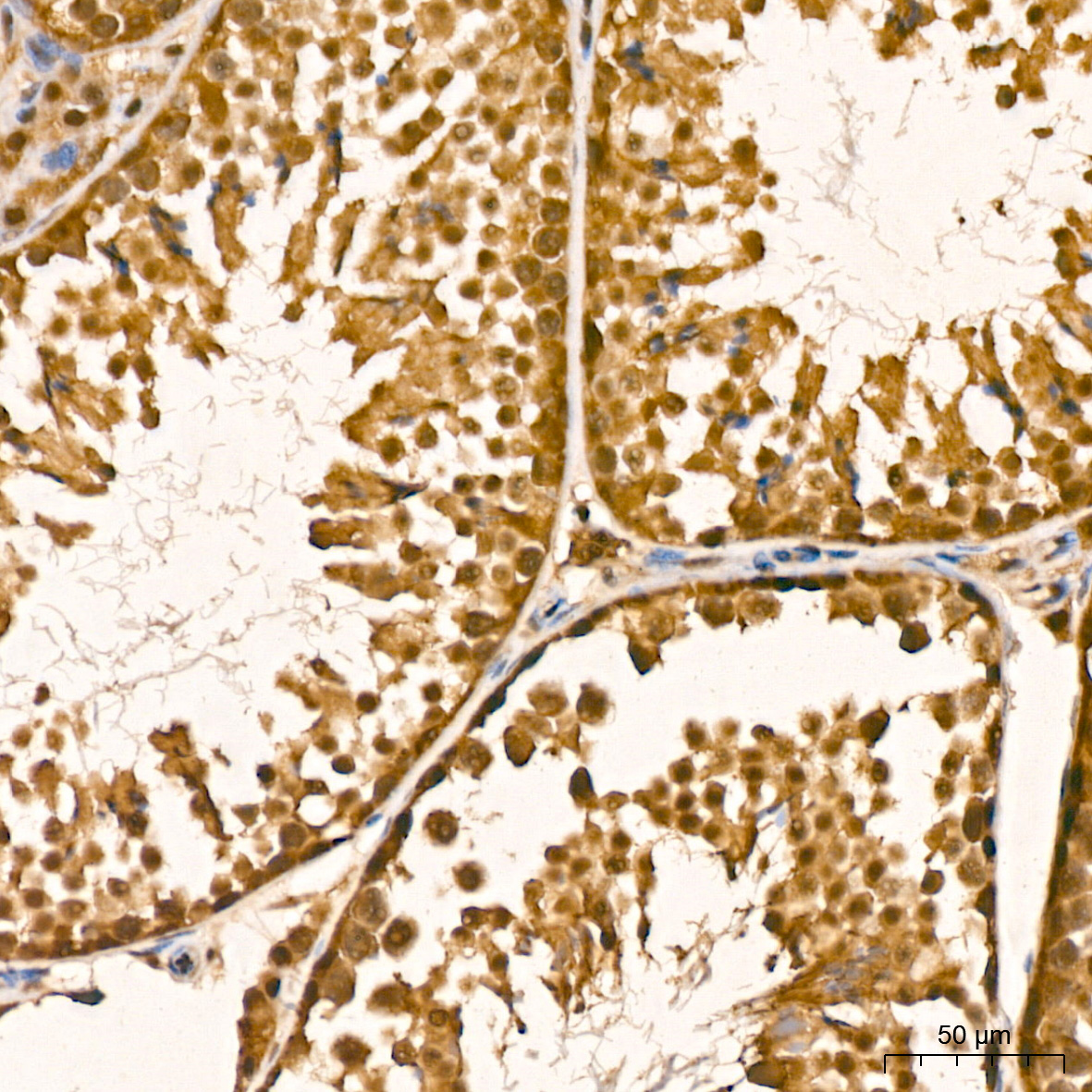 [KD Validated] PSMA7 Rabbit monoclonal antibody