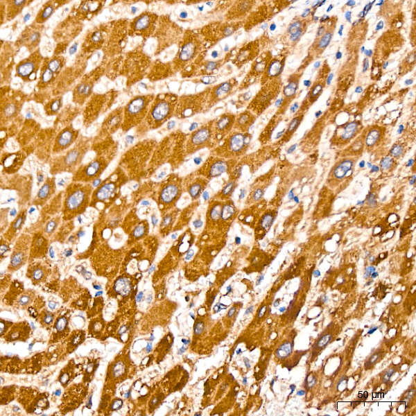 [KO Validated] PCCB Rabbit monoclonal antibody