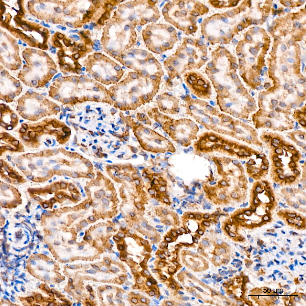 [KO Validated] PCCB Rabbit monoclonal antibody