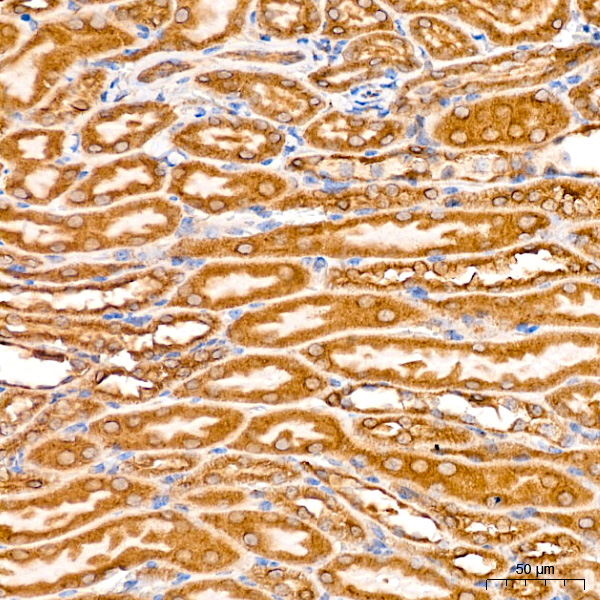 [KO Validated] PCCB Rabbit monoclonal antibody