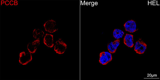 [KO Validated] PCCB Rabbit monoclonal antibody