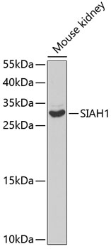SIAH1 Rabbit polyclonal antibody