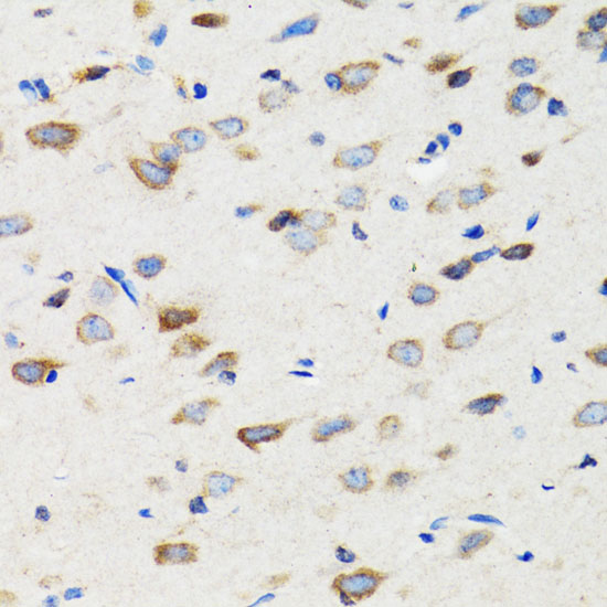 SIAH1 Rabbit polyclonal antibody