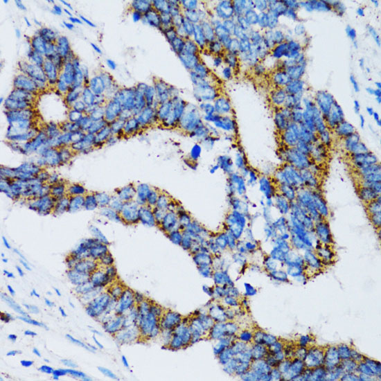 SIAH1 Rabbit polyclonal antibody