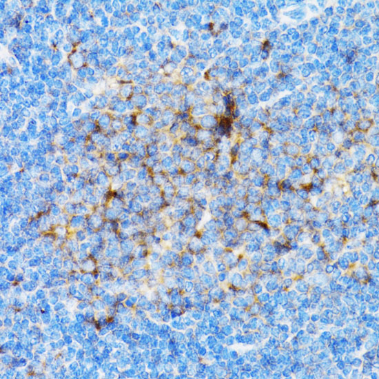 SIAH1 Rabbit polyclonal antibody
