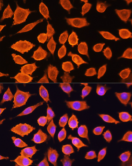SIAH1 Rabbit polyclonal antibody