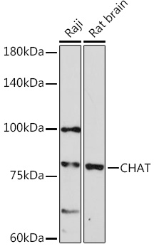 CHAT Rabbit polyclonal antibody