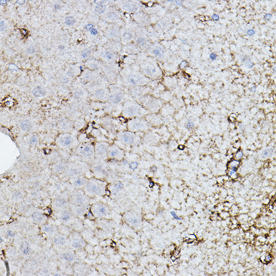 CHAT Rabbit polyclonal antibody