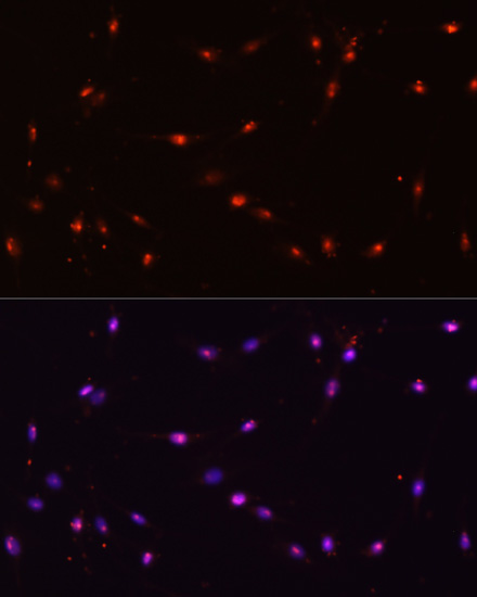 ILF3 Rabbit polyclonal antibody