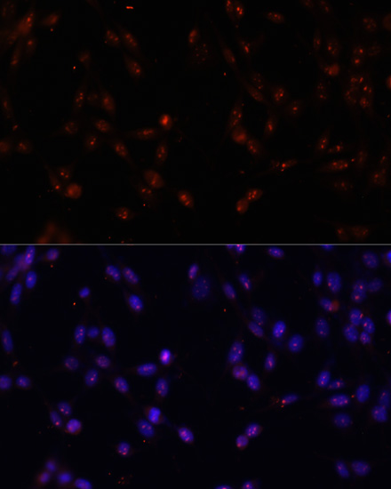 ILF3 Rabbit polyclonal antibody