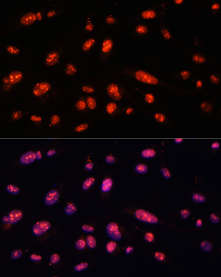ILF3 Rabbit polyclonal antibody