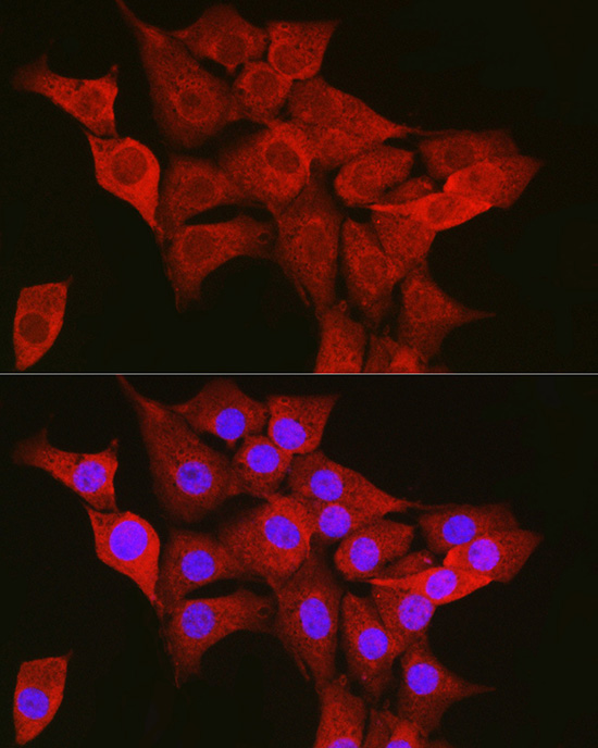 TTK Rabbit polyclonal antibody