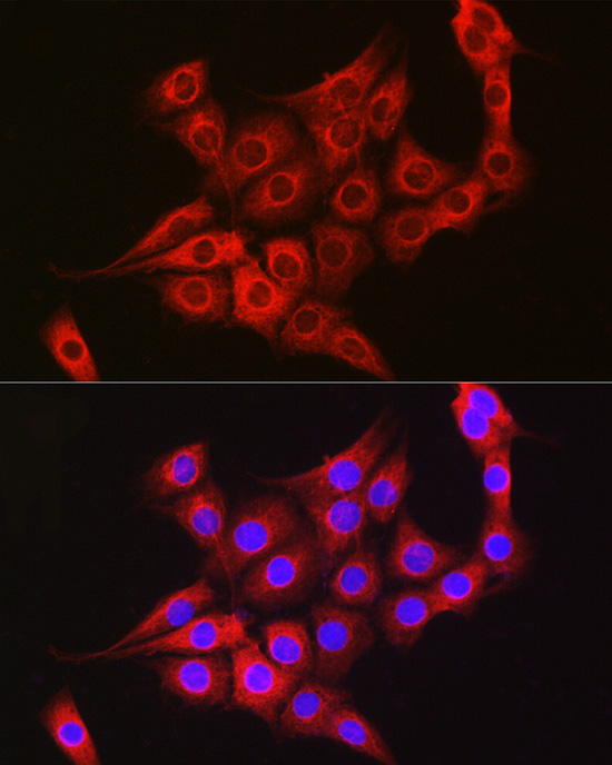 TTK Rabbit polyclonal antibody