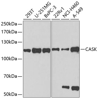 CASK Rabbit polyclonal antibody