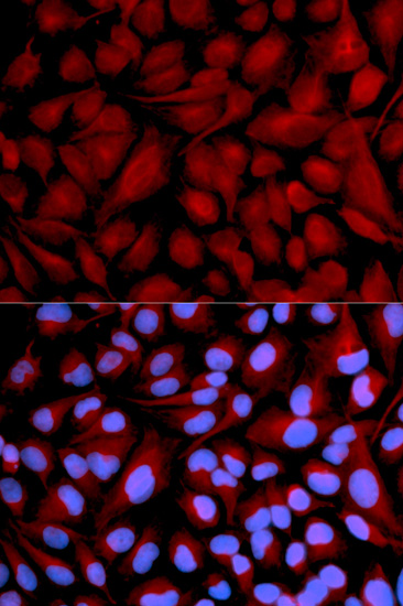 CASK Rabbit polyclonal antibody