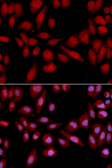 PSMA2 Rabbit polyclonal antibody
