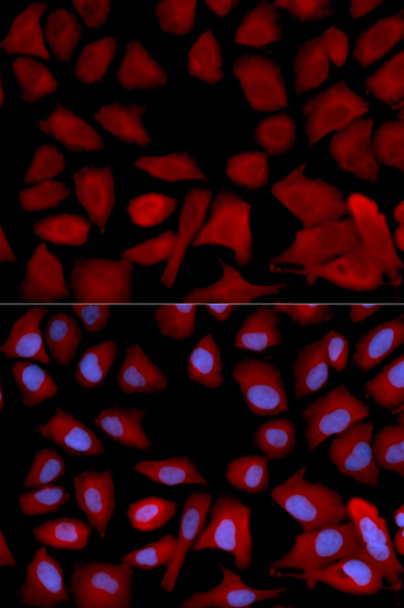 PSMC4 Rabbit polyclonal antibody