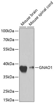 GNAO1 Rabbit polyclonal antibody