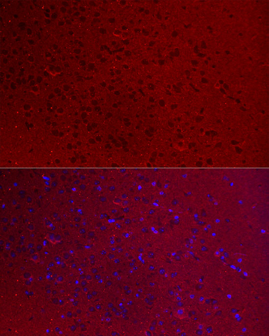 GNAO1 Rabbit polyclonal antibody