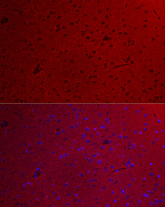 GNAO1 Rabbit polyclonal antibody