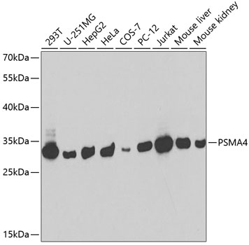 PSMA4 Rabbit polyclonal antibody