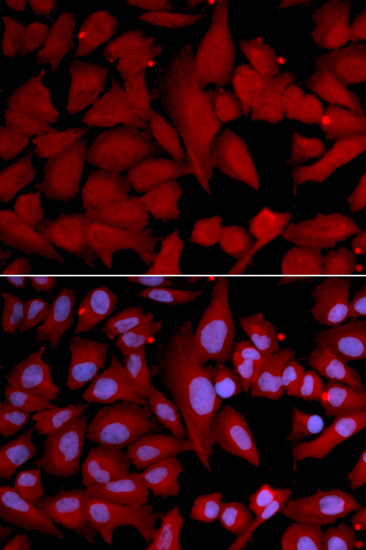 PSMA4 Rabbit polyclonal antibody