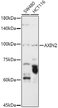 Western blot analysis of various lysates using?AXIN2 Rabbit pAb (A2513) at?1:2000 dilution.<br/>Secondary antibody: HRP-conjugated Goat anti-Rabbit IgG (H+L) (AS014) at 1:10000 dilution.<br/>Lysates/proteins: 25?μg per lane.<br/>Blocking buffer: 3% nonfat dry milk in TBST.<br/>Detection: ECL Basic Kit (RM00020).<br/>Negative control (NC):?A-431.<br/>Exposure time:?180s.
