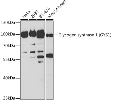 Glycogen synthase 1 (GYS1) Rabbit polyclonal antibody