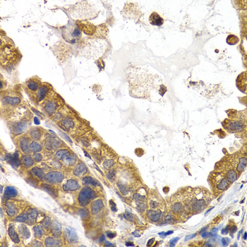 Glycogen synthase 1 (GYS1) Rabbit polyclonal antibody