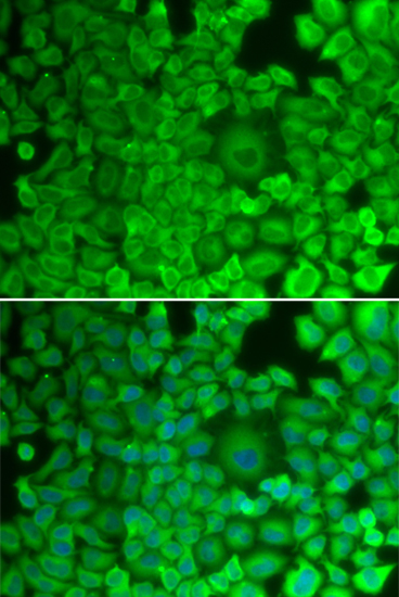 Glycogen synthase 1 (GYS1) Rabbit polyclonal antibody