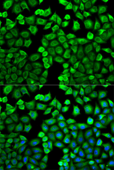 HNMT Rabbit polyclonal antibody
